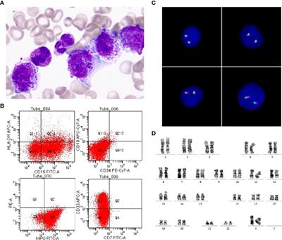 Case report: A rare case of TBL1XR1-RARB positive acute promyelocytic leukemia in child and review of the literature